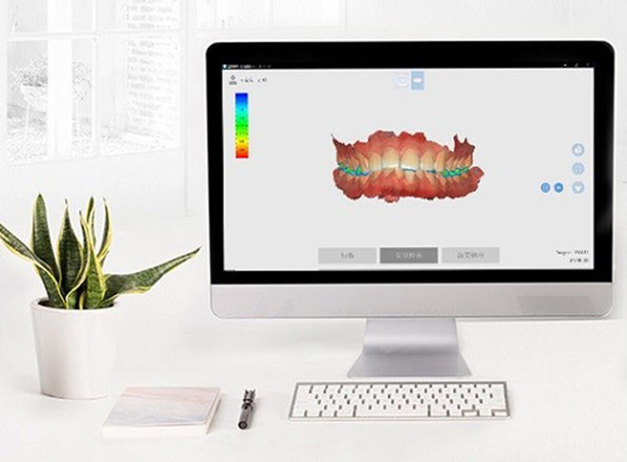 El escÃ¡ner intraoral 3DS capta imÃ¡genes de alta precisiÃ³n y color real.