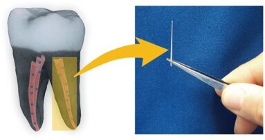 Cientistas testam novos biomateriais de nanodiamantes para tratamento de canal radicular