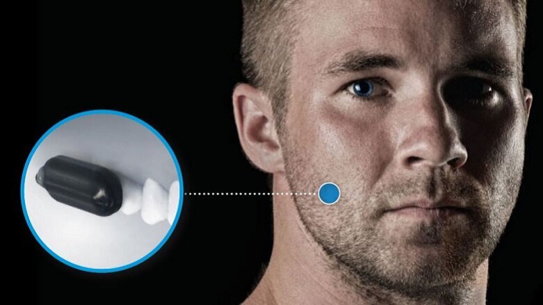 “Molar Mic” personal communication system receives multimillion-dollar DOD funding