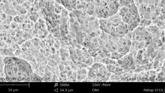 La pureté des implants dentaires prérequis pour le succès clinique
