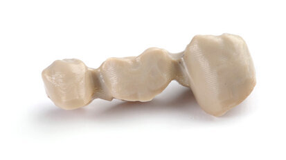 Protesi dentale premium non metallica: Juvora approvata per corone e ponti dentali