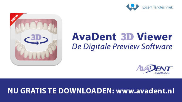 AvaDent 3D Viewer: Digitale Preview Software