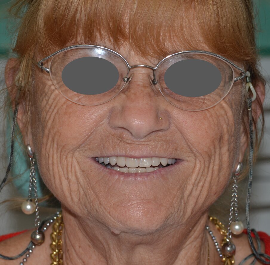 Fig. 21 - Il sorriso finale corrisponde egregiamente al progetto fotografico.