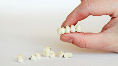 Urteil wegen zu früh eingebrachter Interimsbrücken Urteil wegen zu früh eingebrachter Interimsbrücken