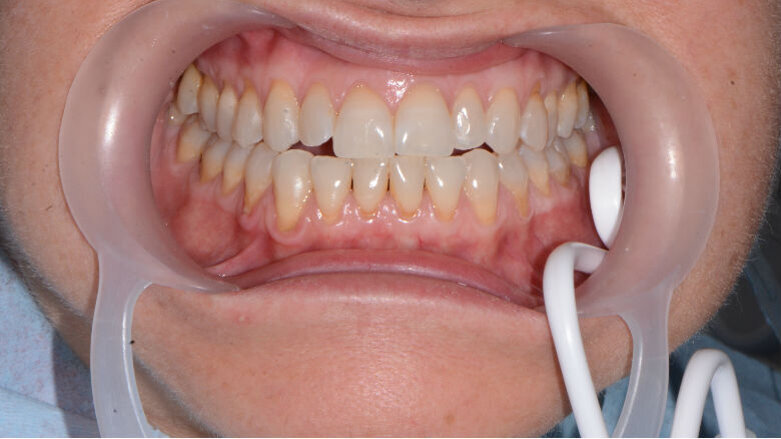 “Ergonomia Odontoiatrica”, benessere per il paziente e per il team-work