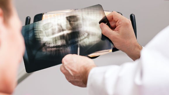 Учени от „Шарите“ проучват методи за надеждното откриване и лечение на кариесите