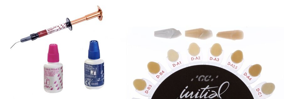 Fig. 16: Cementation using G-CEM Veneer in Shade A2.