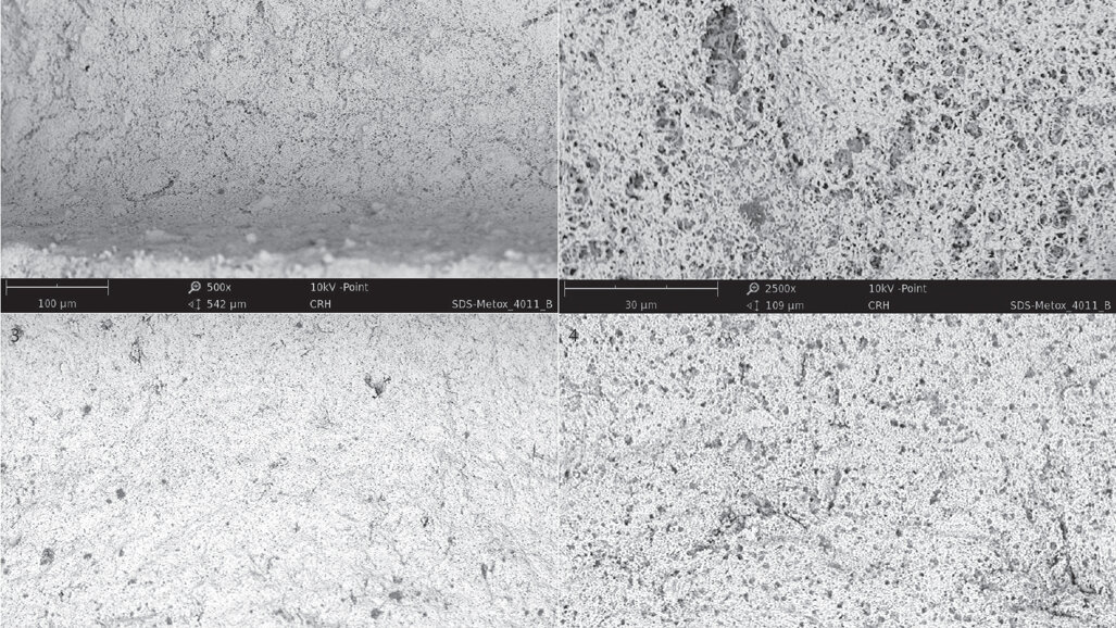 SEM surface analyses of 120 sterile-packed implants