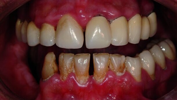 Apport des nouvelles technologies pour le traitement d’un cas complexe