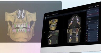 First FDA clearance granted for AI platform analyzing both 2D and 3D dental images