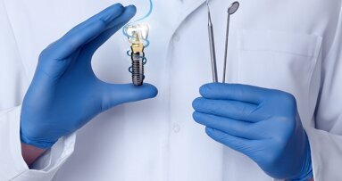 Digital workflows for conversion prostheses in full-arch implant dentistry