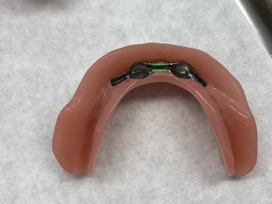 Afbeelding 8. Secundaire deel van gefreesde staaf.