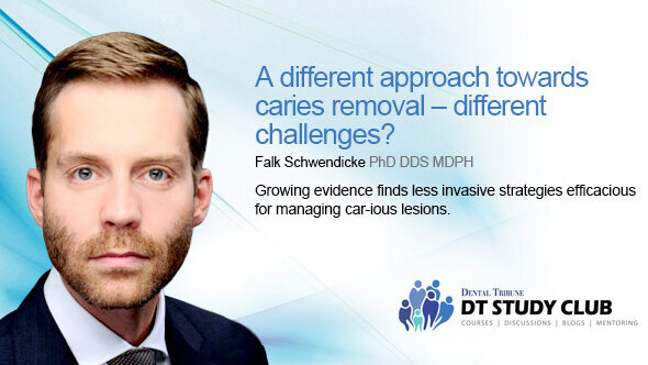 Гледайте уебинар, посветен на различните подходи за отстраняването на кариеси