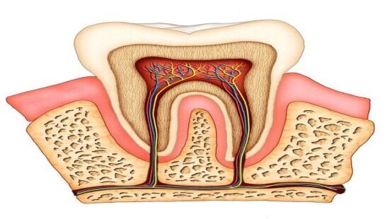 Endodontologen verdeeld over single file-techniek