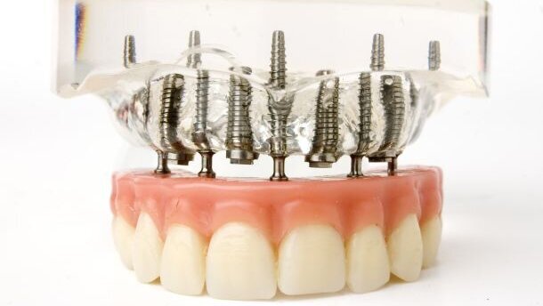 ANT en Schippers botsen over implantaatgedragen prothesen