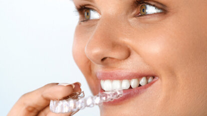 Il segreto invisibile del successo: obiettivi ragionevoli per soddisfare anche il paziente più esigente nel trattamento con allineatori