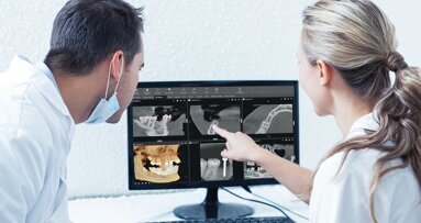 Dlaczego używanie CBCT w Twojej praktyce jest warte rozważenia