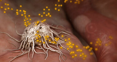 Film en 3D sur l'ostéointégration présenté lors de l’Europerio