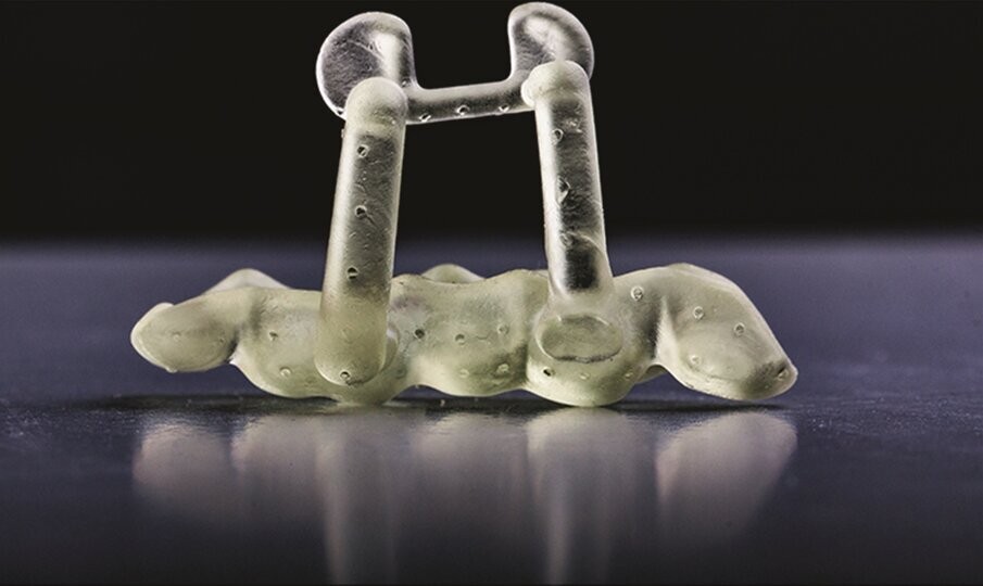 Fig. 2f: Printed template for guided endodontic microsurgery of tooth #15.