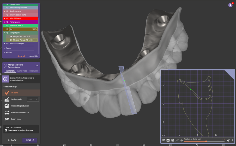 Fig. 9: Bar and suprastructure merged as two individual parts. 