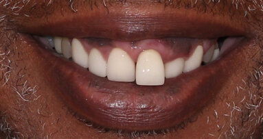 Un flux de travail numérique pour une réussite esthétique prédictible