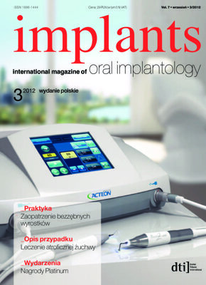 implants Poland No. 3, 2012 implants Poland No. 3, 2012