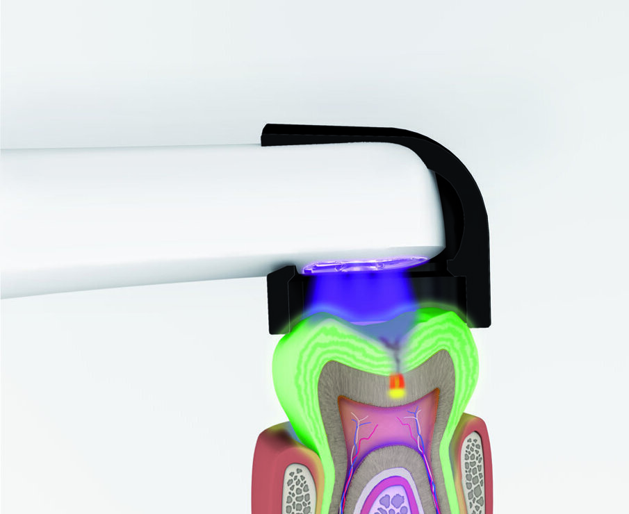 4-vistacam_iX_technik