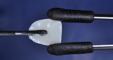 Front-tooth restoration to go