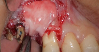 Use of 3D technology in the diagnosis and treatment of endodontic disease