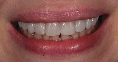 Let patients test-drive their new smiles