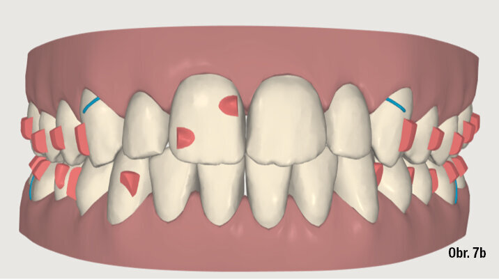 Kazuistika - popis v textu