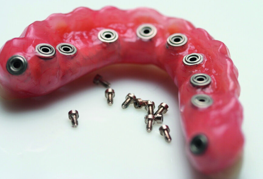 Fig. 6b : Bagues collées dans l’intrados de l’armature.