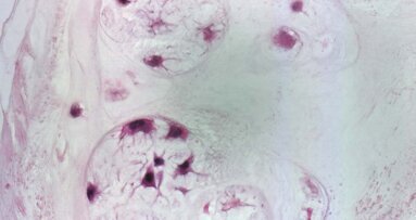 Nasce BioCell Collagen II, la sostanza innovativa per combattere l’ATM