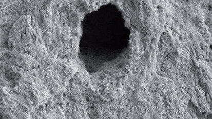 Klinické použití Er,Cr:YSGG laseru při endodontickém ošetření