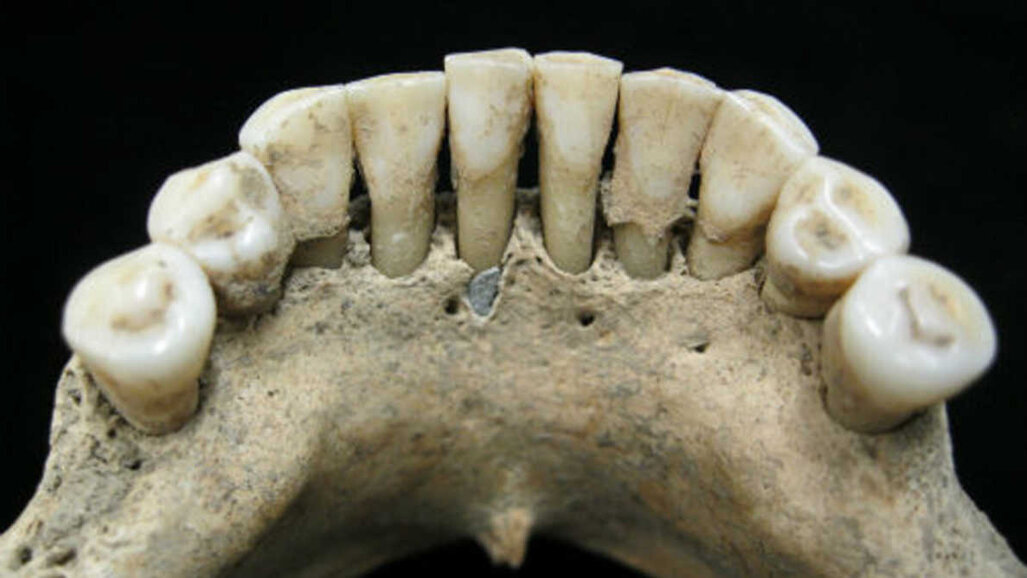 Naukowcy odkryli pigmenty lapis lazuli w szczątkach średniowiecznej kobiety