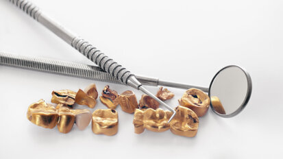 Aufruf zur Zahngoldspende für kostengünstige Augenmedizin Aufruf zur Zahngoldspende für kostengünstige Augenmedizin