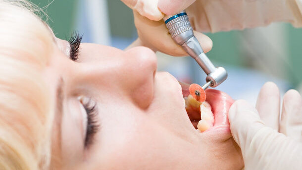 Almost three-quarters of men want their partner to undergo cosmetic dental surgery