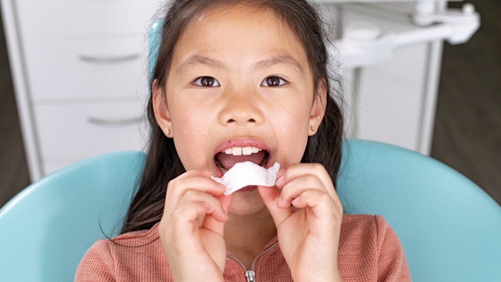 Align Technology’nin Invisalign Üst Çene Genişletme Apareyi, Türkiye’de Kullanıma Sunuldu