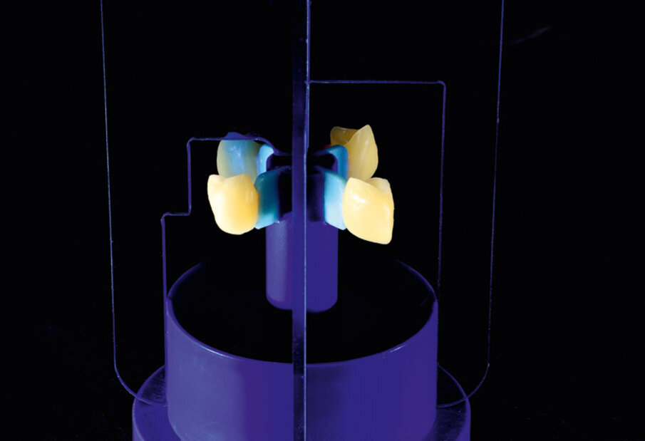 Fig. 11: Full-contour wax crowns attached to the IPS Multi investment ring base and verification of the position of the wax crowns with the help of the IPS Sprue Guide