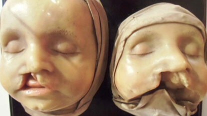 Schau über Alltag der Zahnärzte von anno dazumal