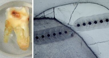 Naukowcy znaleźli nowe dowody na temat diety średniowiecznej ludności