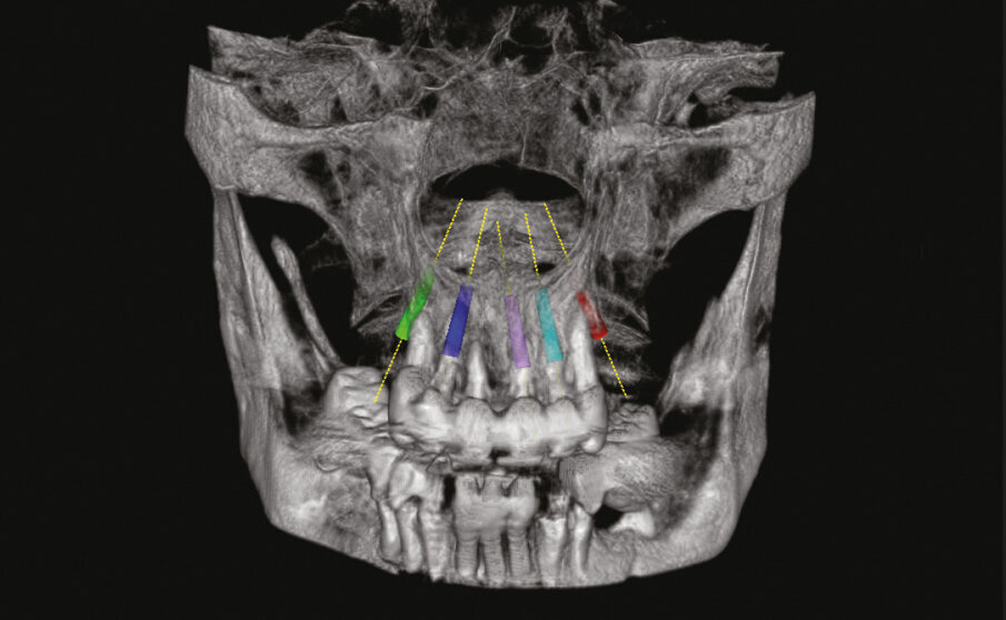 Fig. 2 - Progettazione 3D.