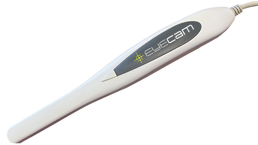 New EyeCam gets clean images with the press of a single button