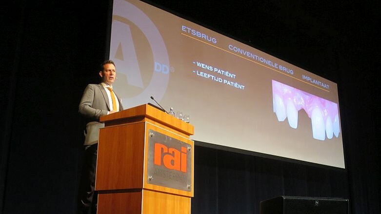 Opvullen van een diasteem: wat te doen?