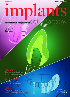 implants international No. 4, 2017 implants international No. 4, 2017