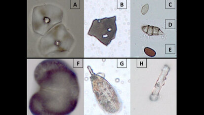 Ancient dental plaque reveals living conditions and diet of early hominins