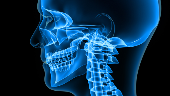 Nach Unfall: Teenager kann Kiefer wieder bewegen