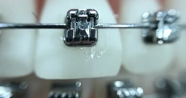 Diagnostyka rezonansem magnetycznym u pacjentów ortodontycznych