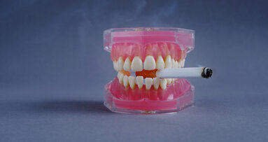 Study compares effect of electronic cigarettes, cigarettes, waterpipes and smokeless tobacco on dental implants