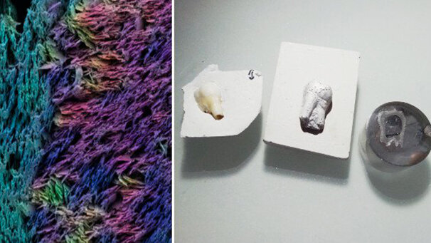 Creato in Svizzera un dente artificiale che imita la microstruttura naturale